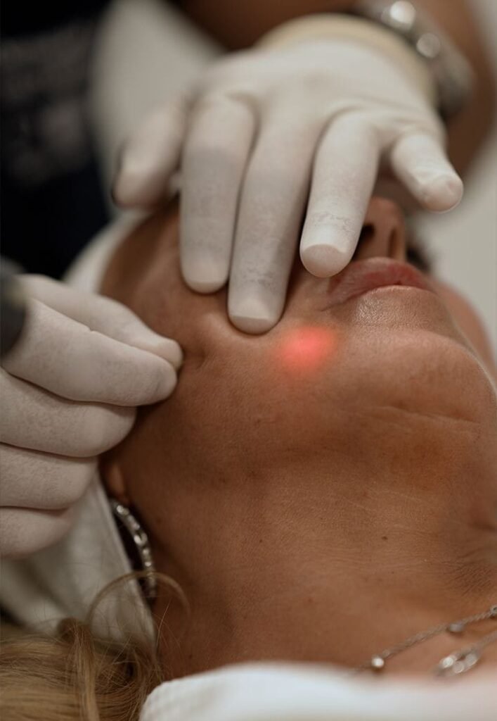 Endoface & Bodylift – ošetření brady