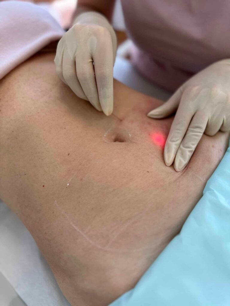 Endoface & Bodylift – ošetření těla