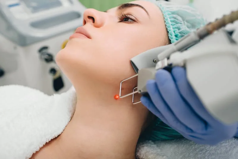 Endoface & Bodylift – laserové ošetření linie čelisti